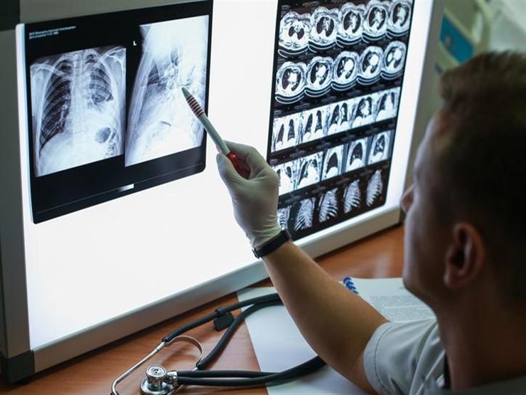 دون انتظار تحليل pcr.. الصحة تكشف نسب دقة تشخيص حالات كورونا بالأشعة دون انتظار تحليل pcr.. الصحة تكشف نسب دقة تشخيص حالات كورونا بالأشعة
