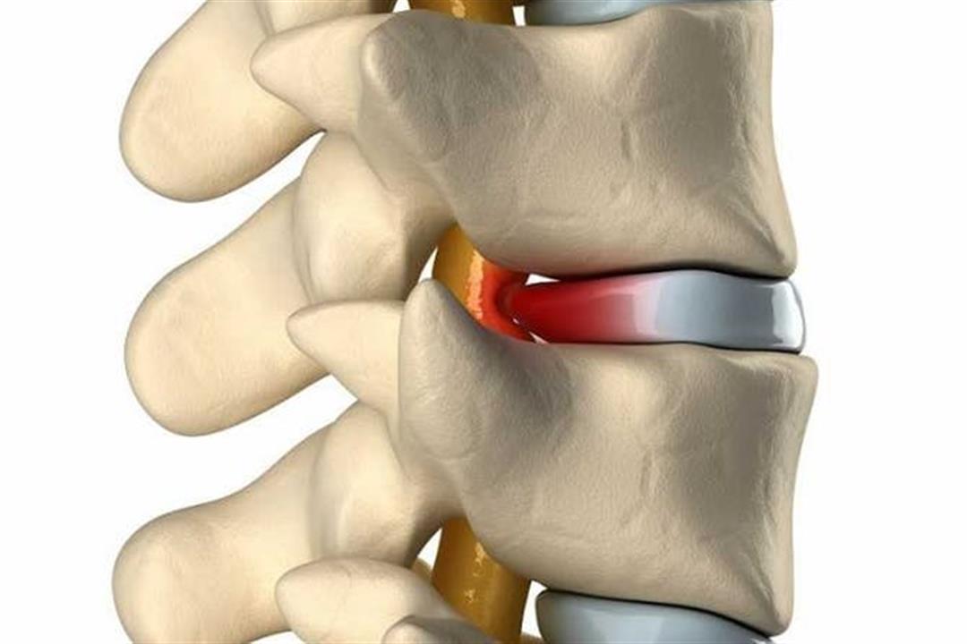 اضرار التيك توك 5