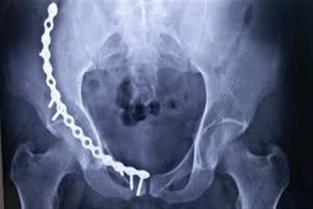 اضرار التيك توك 9