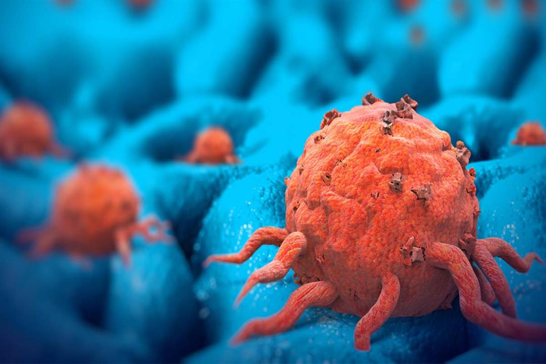 علماء يكتشفون طريقة جديدة لعلاج أخطر أنواع السرطان