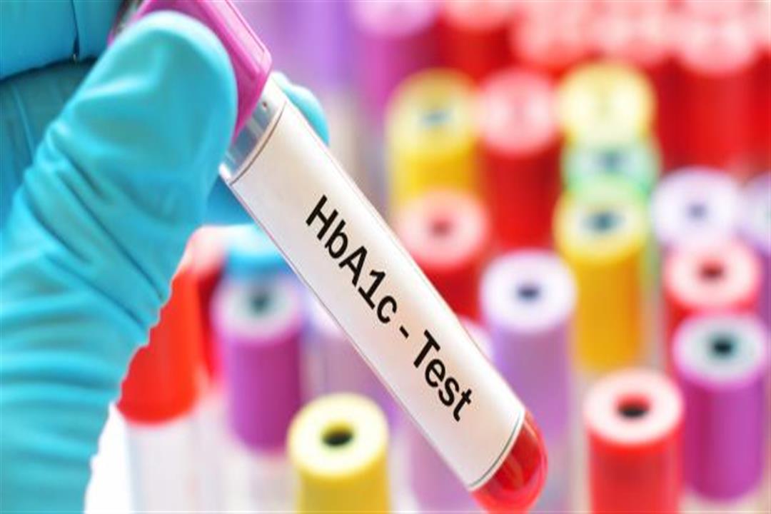 الفحص الاأول