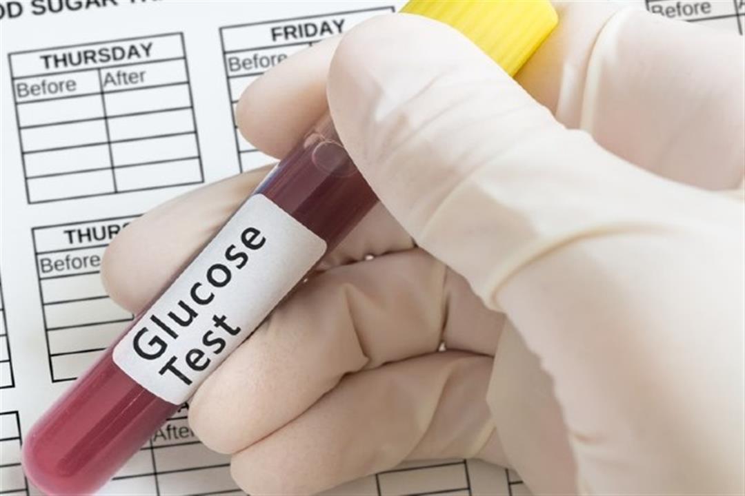 الفحص الثالث