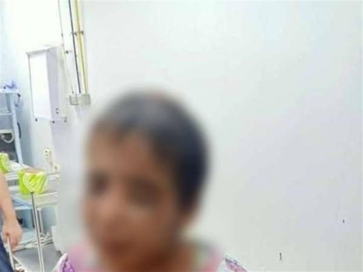المستشار الطبي لمجلس الوزراء: علاج الطفلة أمنية ضحية التعذيب على نفقة الدولة