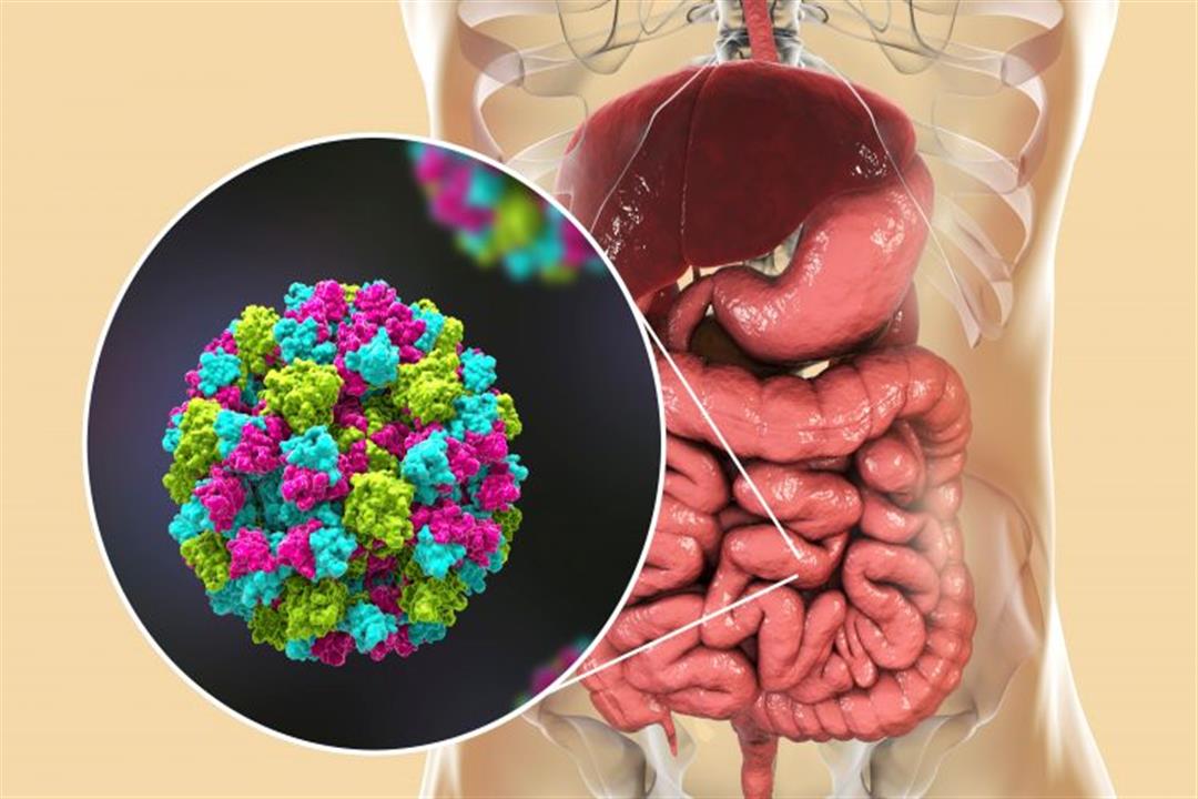 تحذيرات من نوروفيروس هذا الشتاء- ما أعراضه؟ 