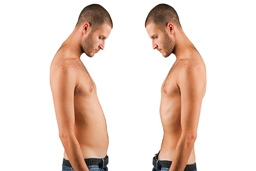 فقدان العضلات