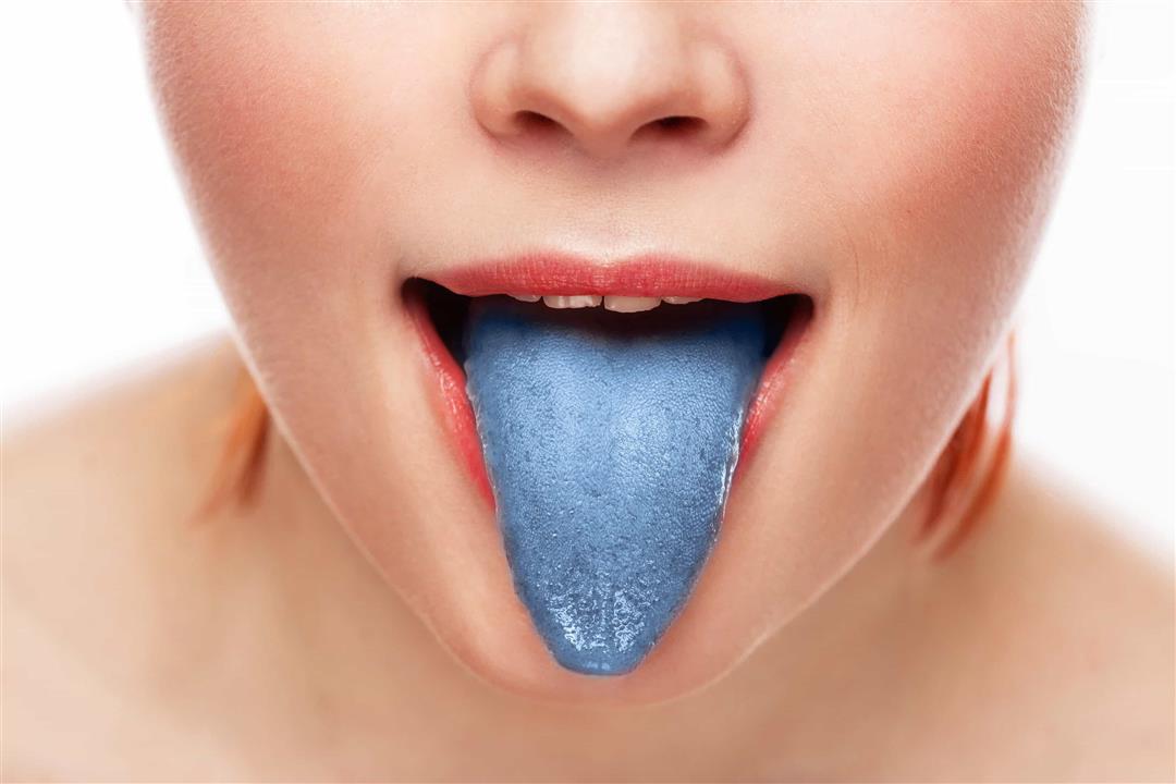 ازرقاق اللسان