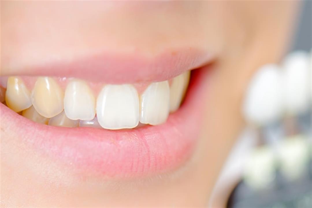 6 طرق طبيعية قد تخلصك من اصفرار الأسنان | الكونسلتو