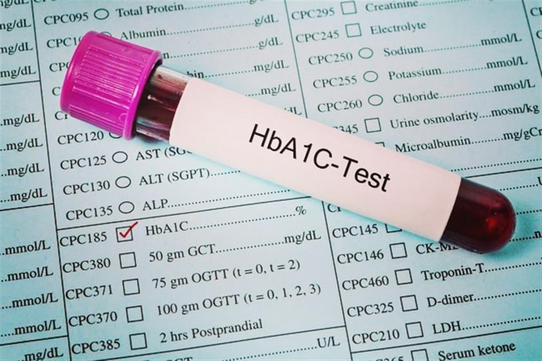 هيموجلوبين السكري