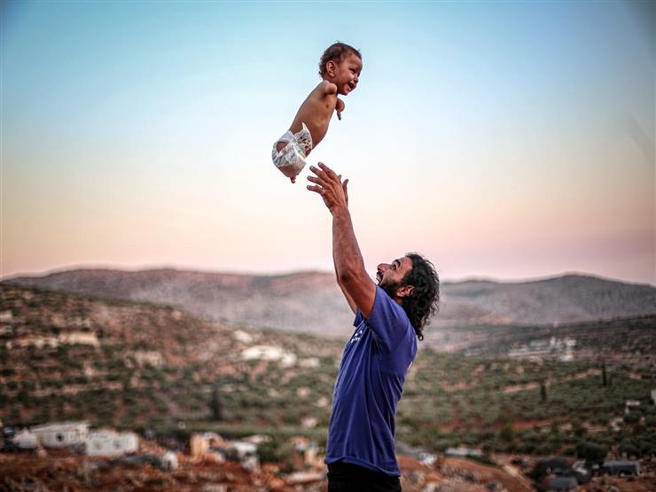 ضحكة في سماء المخيم.. صورة تساعد في تركيب أطراف لطفل سوري ضحكة في سماء المخيم.. صورة تساعد في تركيب أطراف لطفل سوري