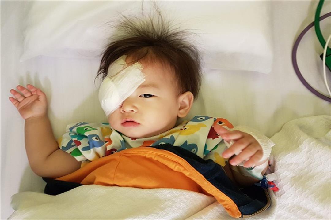 سرطان العين عند الأطفال.. طبيب يوضح أعراضه وكيفية علاجه 