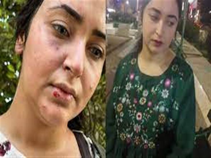 صيدلانية تكشف تفاصيل اعتداء زميلاتها عليها بسبب الحجاب.. والمحافظ: "ننتظر قرار النيابة"