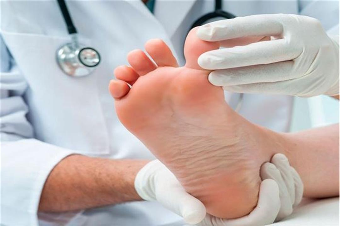 السكري.. دليلك لحماية القدمين من مضاعفات المرض