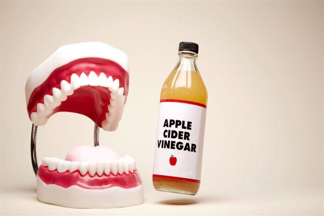 خل التفاح.. هل يساعد على تبييض الأسنان؟