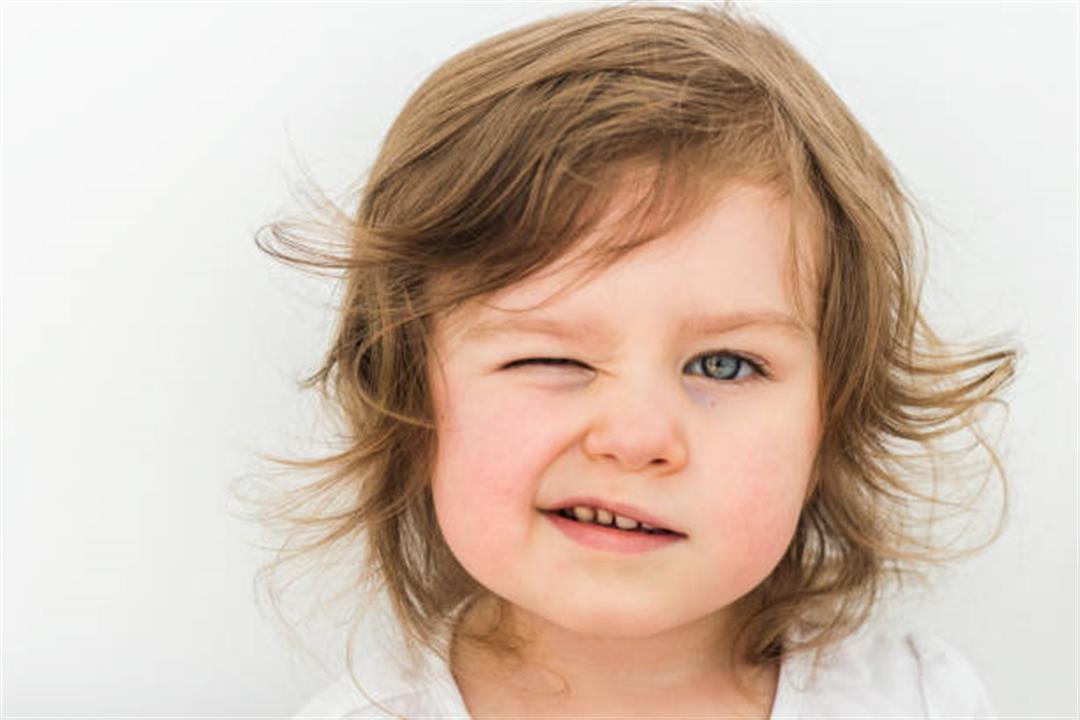 بربشة العين عند الأطفال.. حالة طبيعية أم مرضية؟