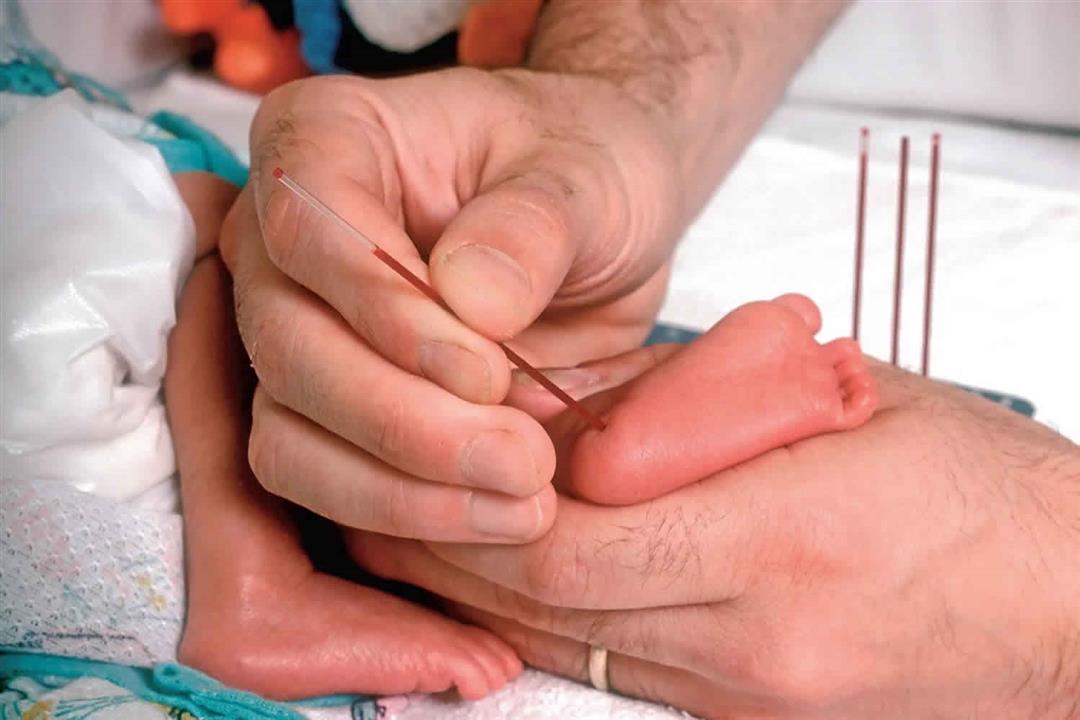 تحليل كعب القدم للمولود.. طبيبة: يكشف عن 19 مرض وراثي