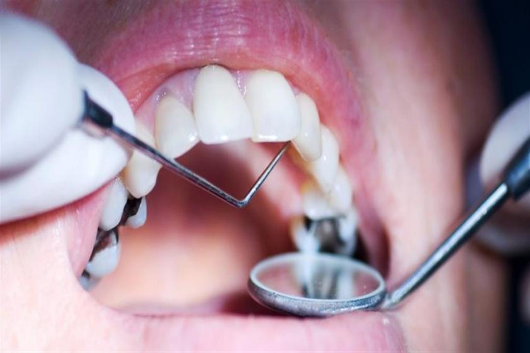 تظهر على الأسنان.. علامة خطيرة قد تدل على هشاشة العظام