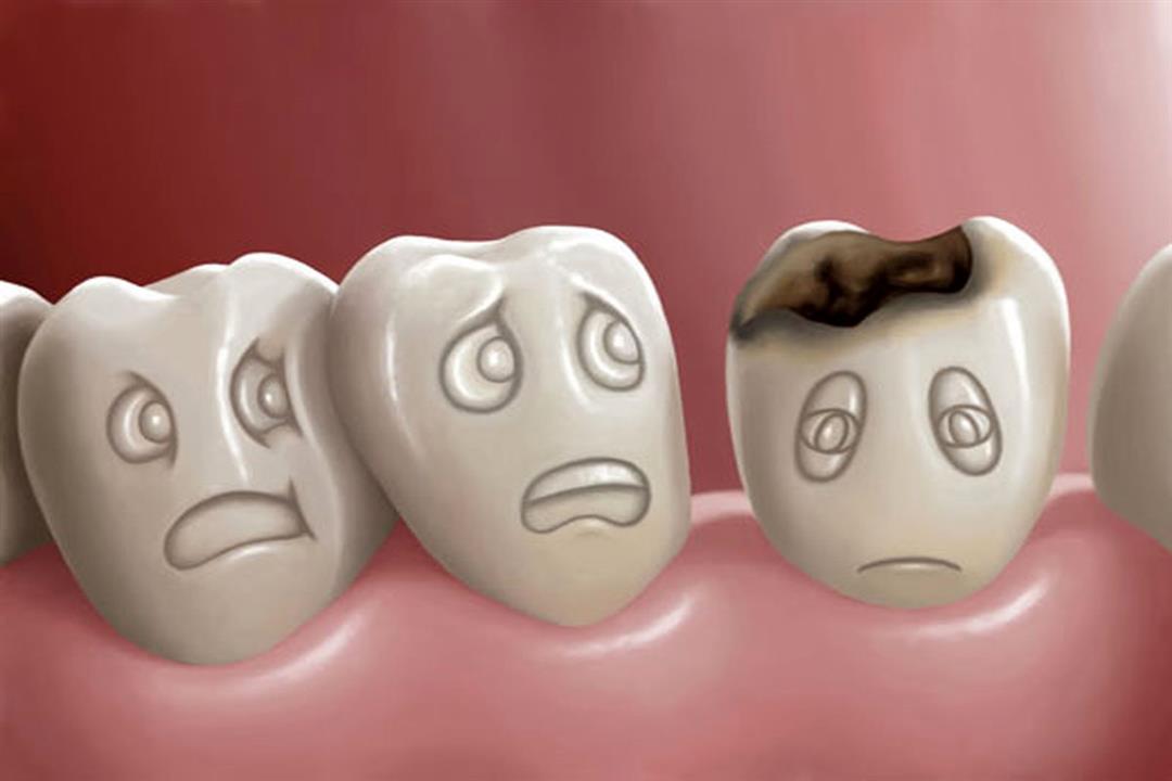 مخاطر متعددة لوجود فراغ في حشو الأسنان.. إليك أبرزها