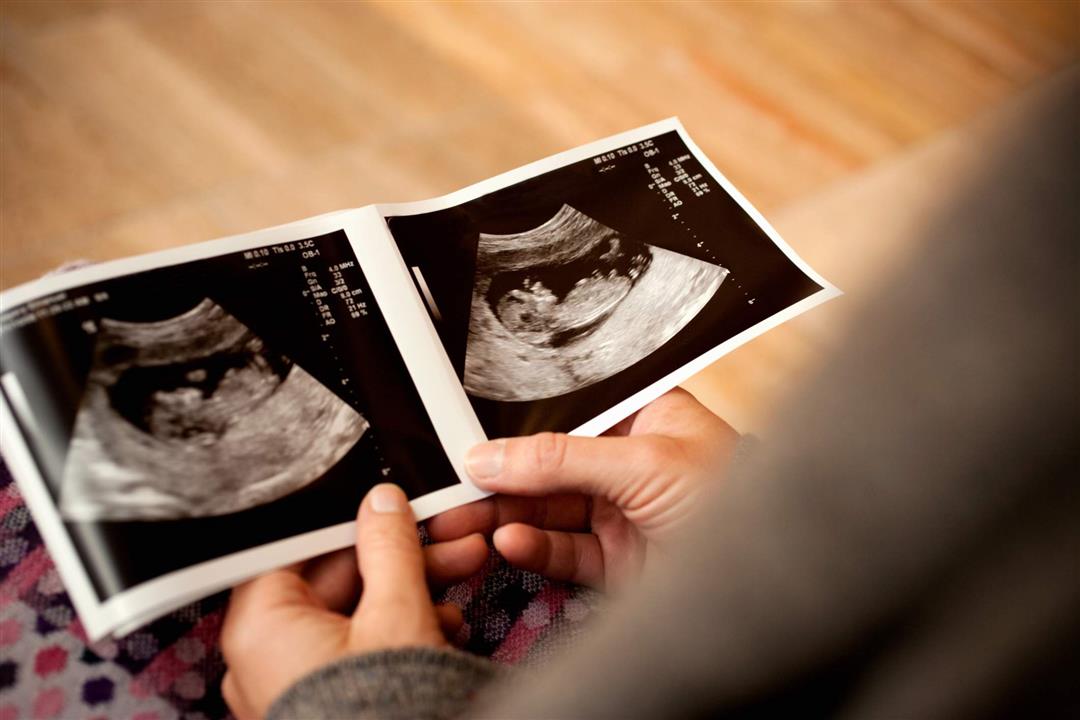 ولد أم بنت؟.. أعراض الحمل دليلِك لمعرفة نوع الجنين بدون سونار