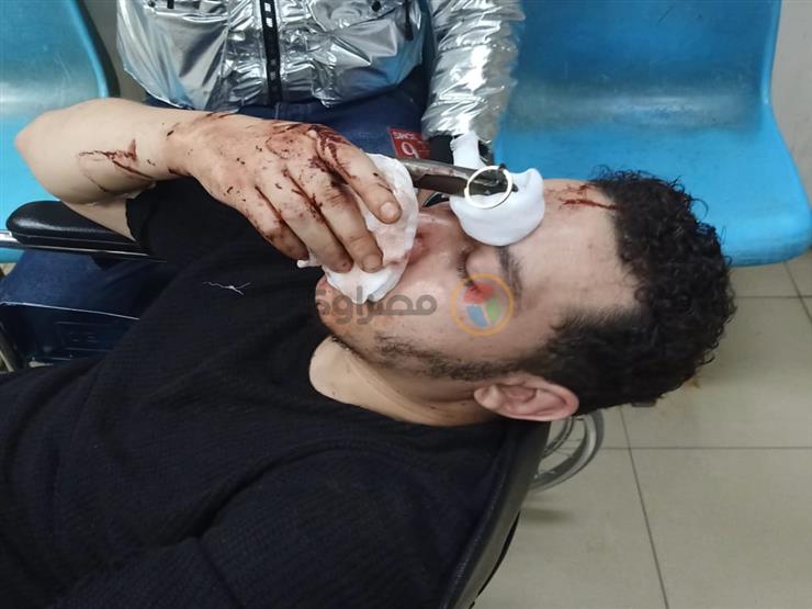 "8 ساعات بيطلعوا المطواة من راسه".. تفاصيل التعدي على شاب بالزاوية الحمراء بسبب "الحمام" "8 ساعات بيطلعوا المطواة من راسه".. تفاصيل التعدي على شاب بالزاوية الحمراء بسبب "الحمام"
