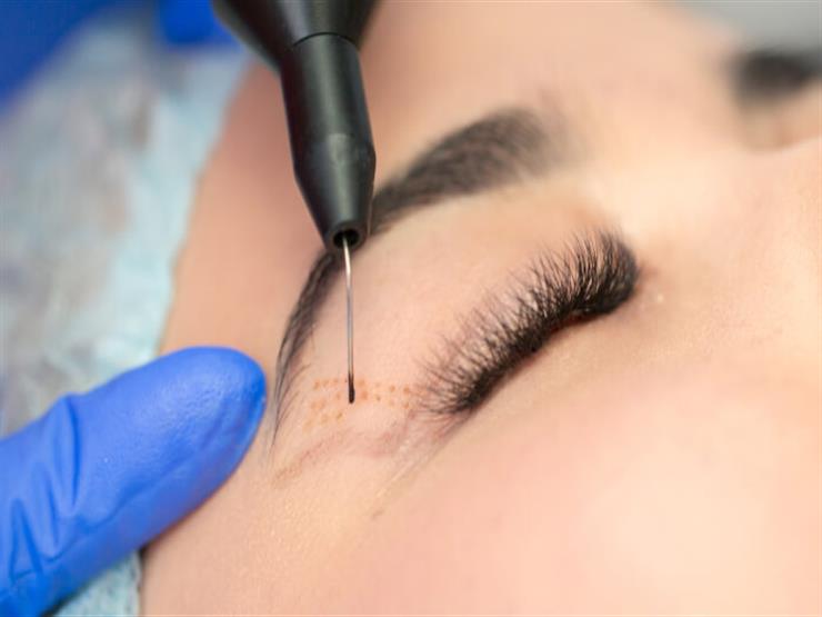 نبيل فقيه: هذه الأسباب تجعل النساء تخضع لعملية تجميل الجفون نبيل فقيه: هذه الأسباب تجعل النساء تخضع لعملية تجميل الجفون