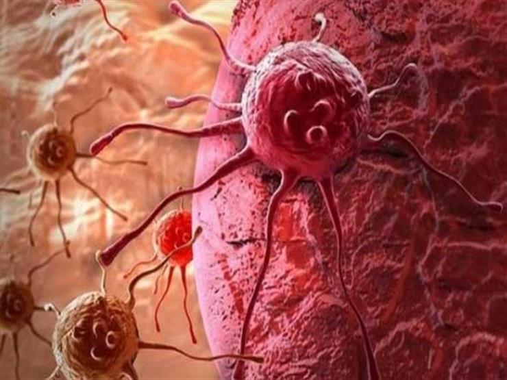 اكتشفها باحثون في 2022.. 6 أشياء قد ترتبط بالسرطان