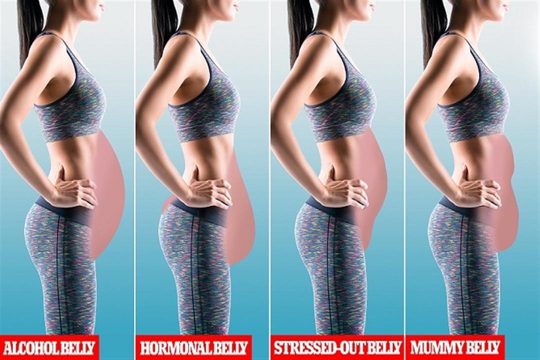 أنواع الكرش