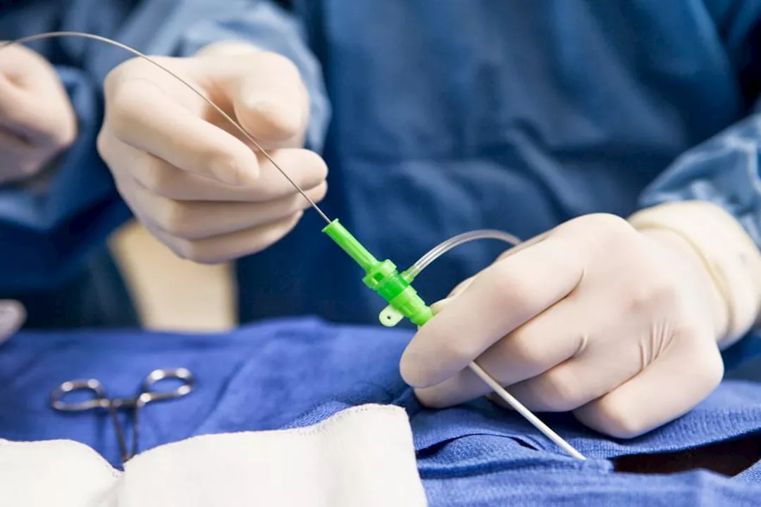 ما دور القسطرة في تشخيص أمراض الشرايين بدقة؟