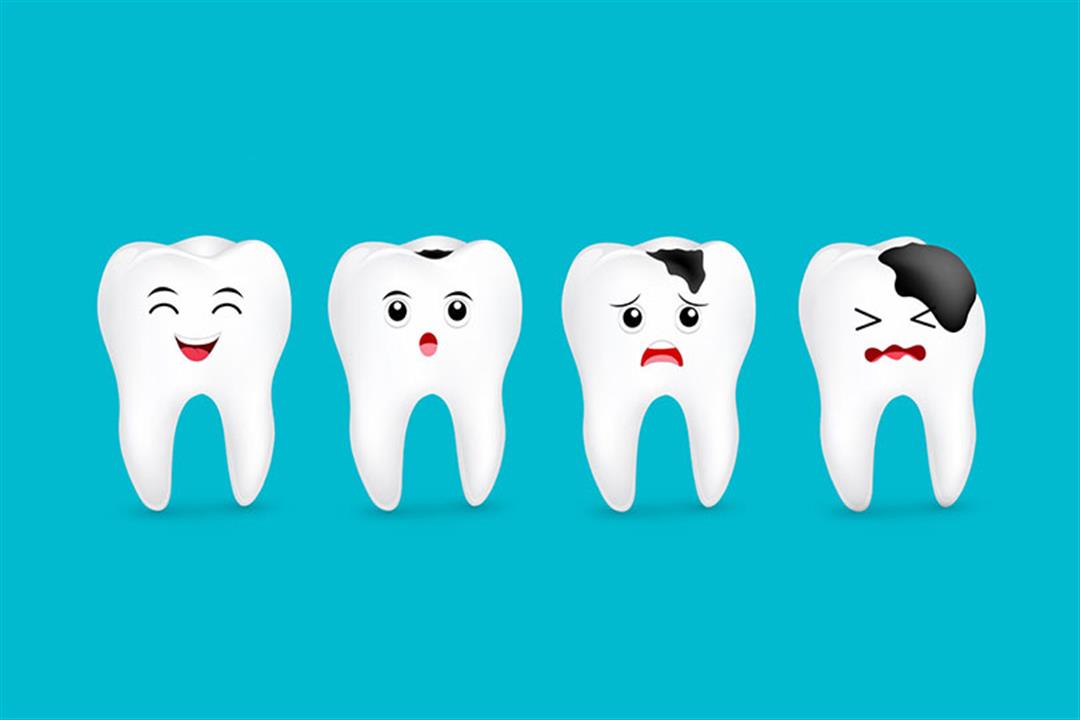 ماذا يحدث عند تسوس الأسنان؟.. 5 مراحل تمر بها أسنانك