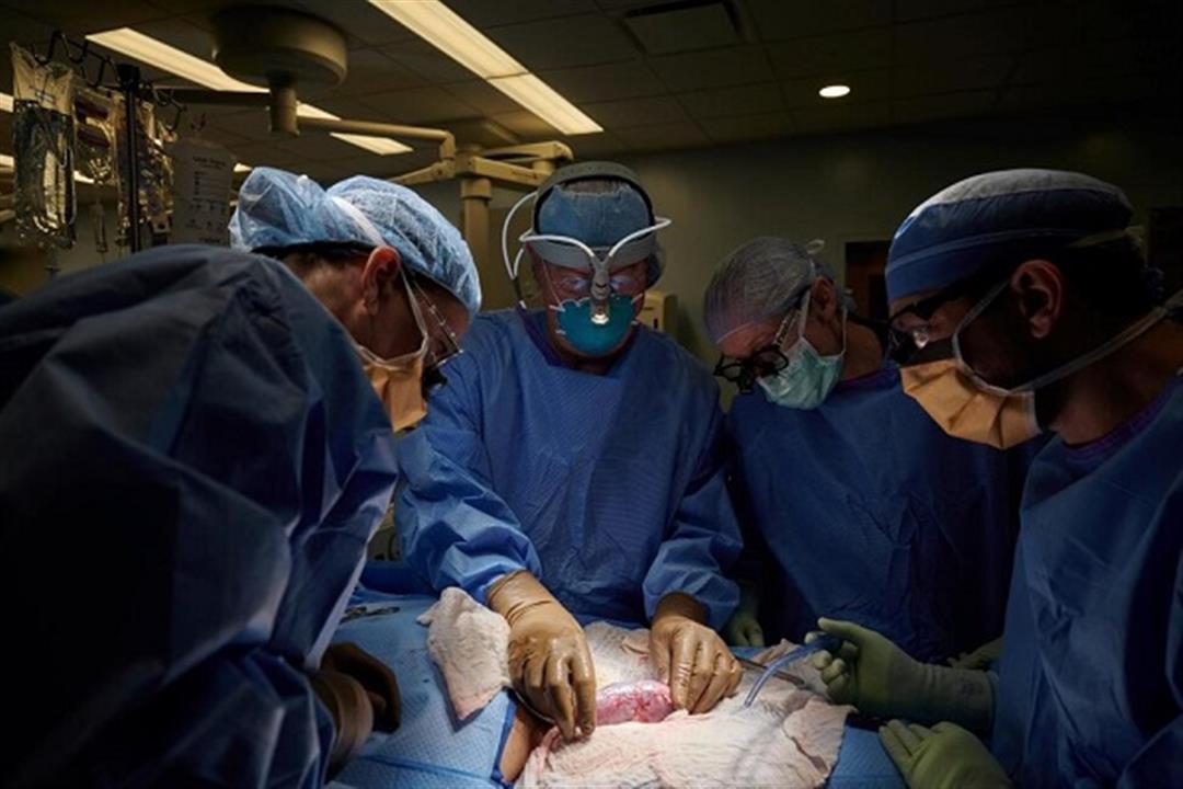 كواليس عملية زراعة قلب خنزير في جسم إنسان.. كيف استعد لها الأطباء؟