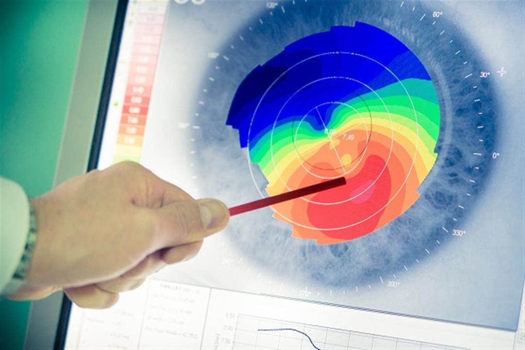 قد يسبب العمى.. 7 أعراض تكشف إصابتك باعوجاج القرنية