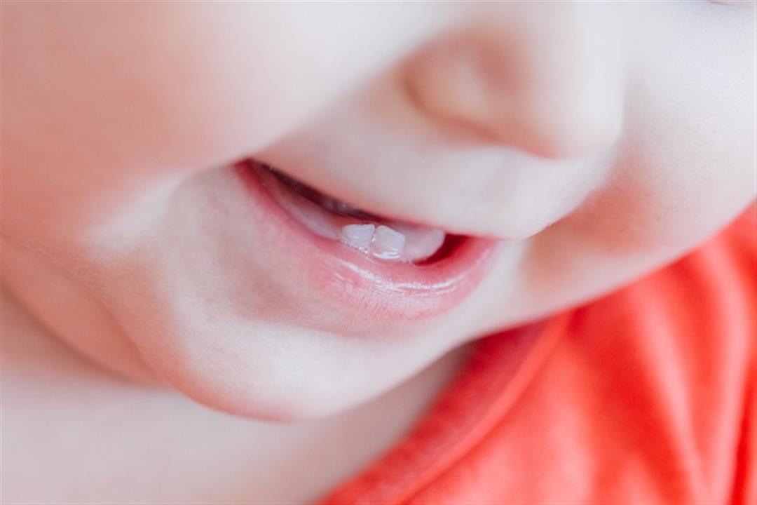 حالة نادرة- لماذا يولد بعض الأطفال بأسنان؟