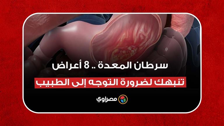 سرطان المعدة.. 8 أعراض في مرحلة مبكرة تنبهك لضرورة التوجه إلى الطبيب