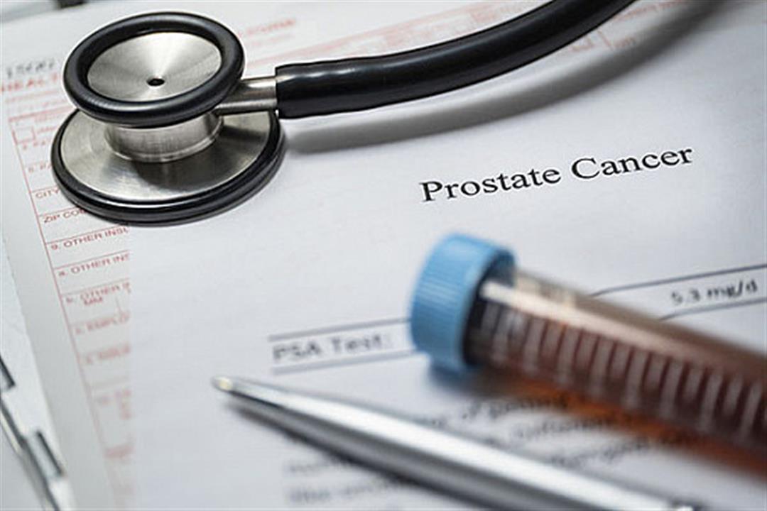 4 أنواع من سرطان البروستاتا-أيهم أكثر شيوعًا؟