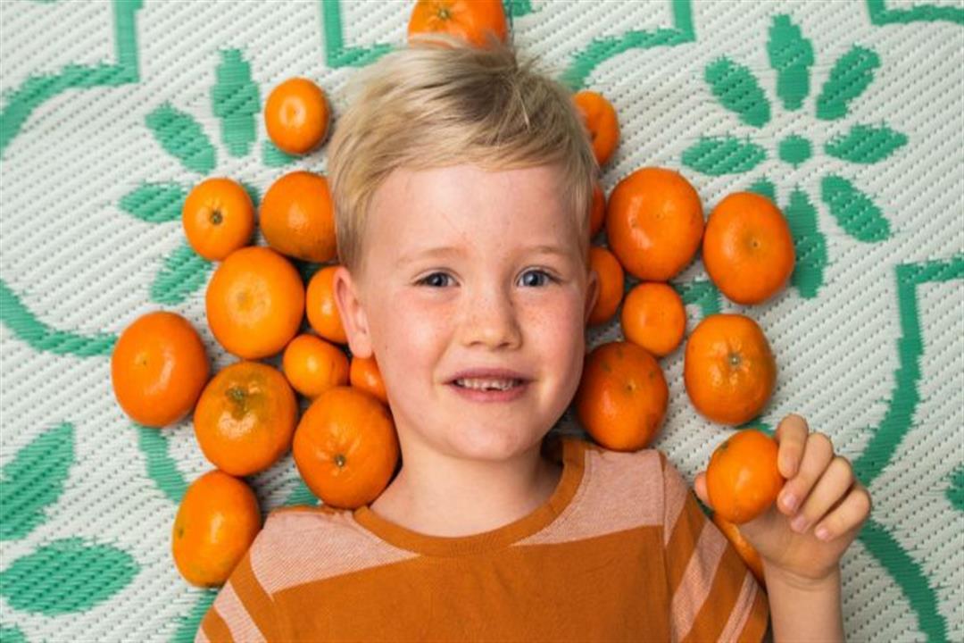 بسبب تناوله الكثير من البرتقال – طفل يتحول لون جلده للأصفر