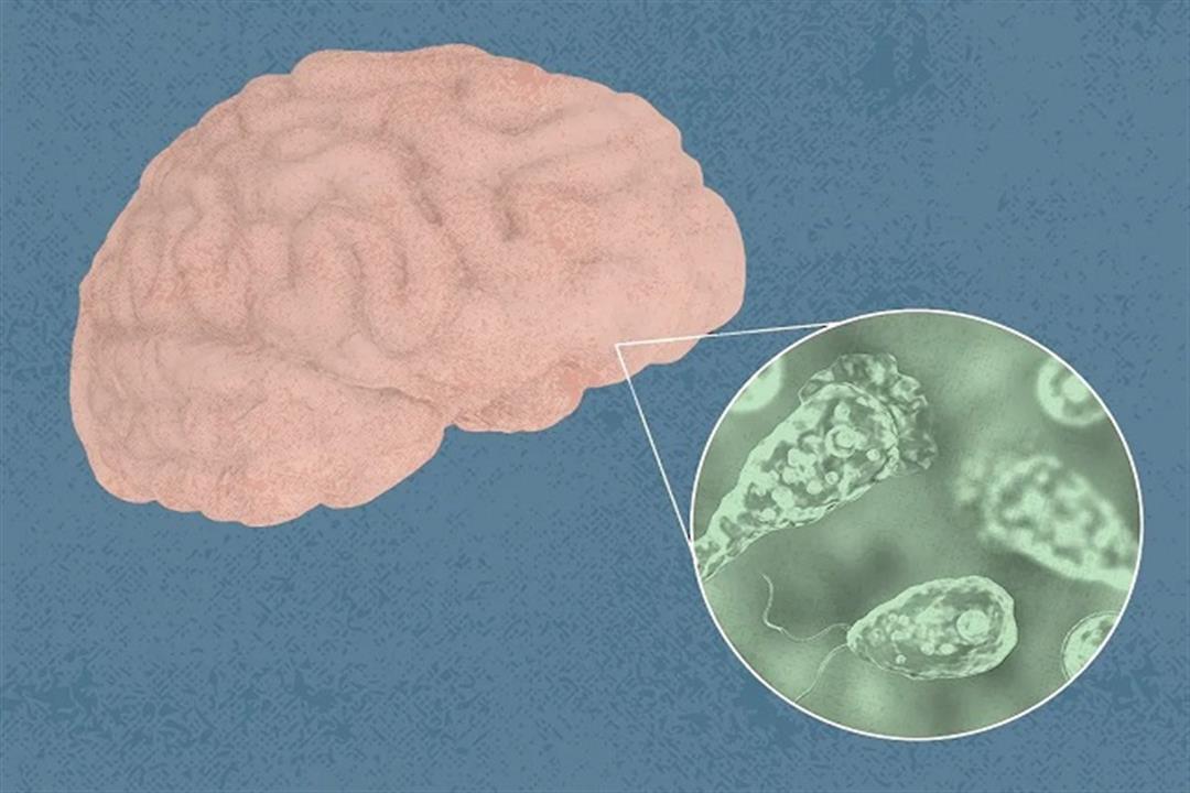 الأميبا الآكلة للدماغ- معلومات قد تهمك عنها "فيديوجرافيك"