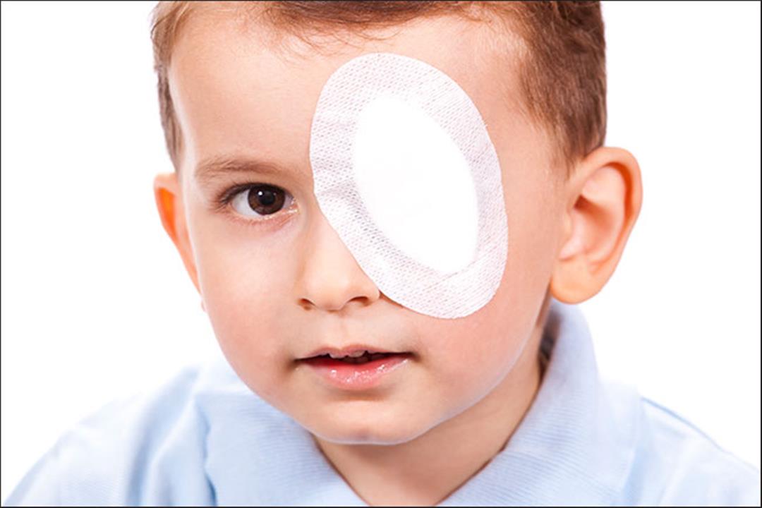 إصابة الأطفال بإعتام عدسة العين- واردة أم مستبعدة؟