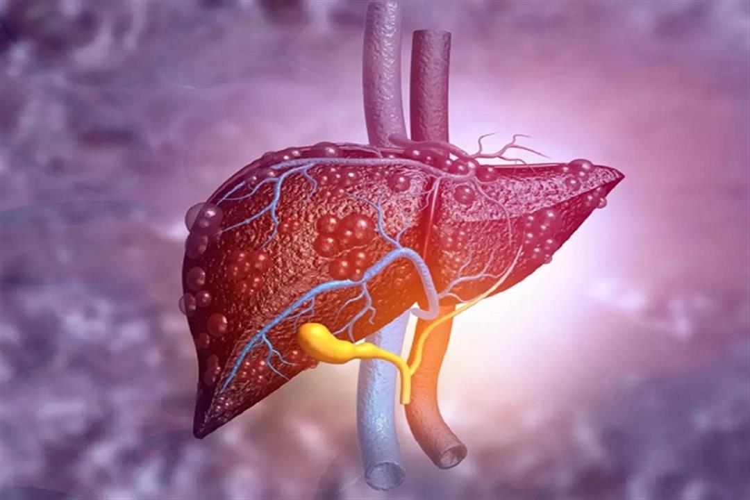 بعد الالتهاب الغامض- كيف يؤثر كورونا على الكبد؟