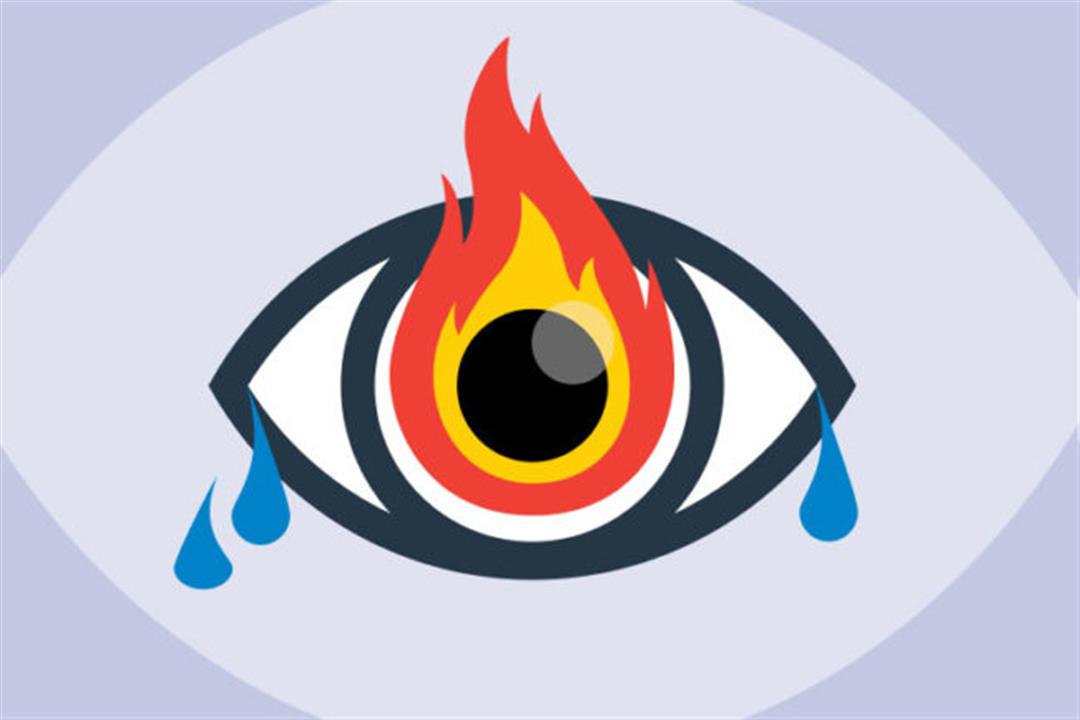 تستحق التجربة- 8 طرق طبيعية لعلاج حرقان العين