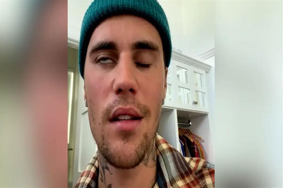 JUSTIN-BIEBER-ΠΑΡΑΛΥΣΗ-ΠΡΟΣΩΠΟΥ