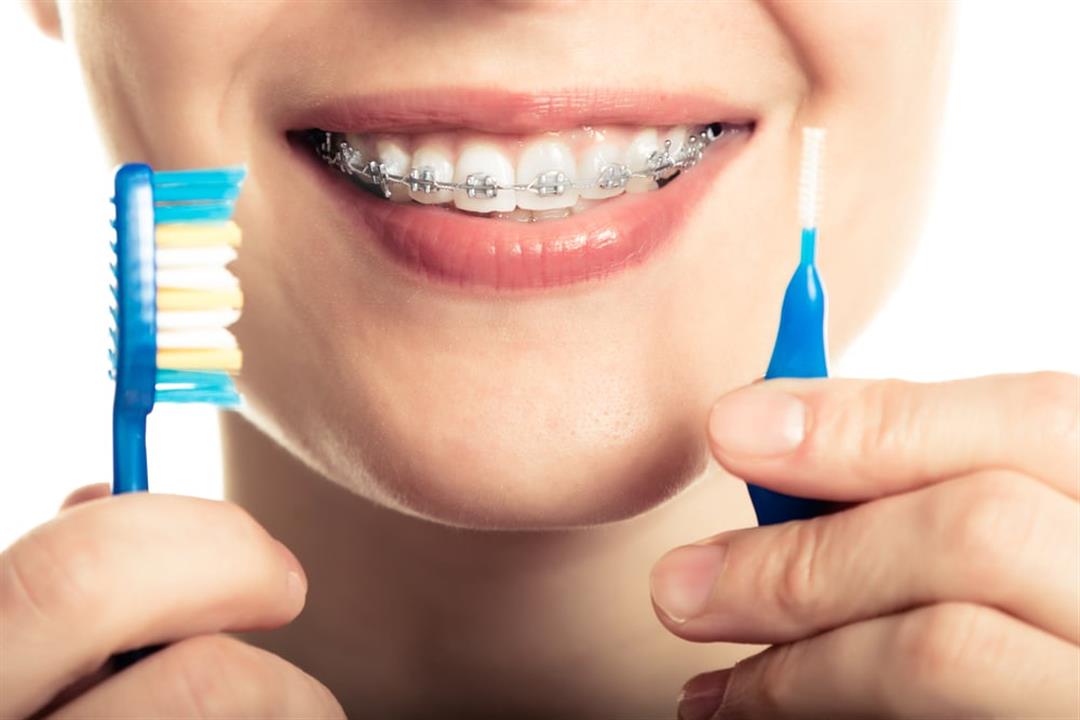 كيف تختار فرشاة تقويم الأسنان؟