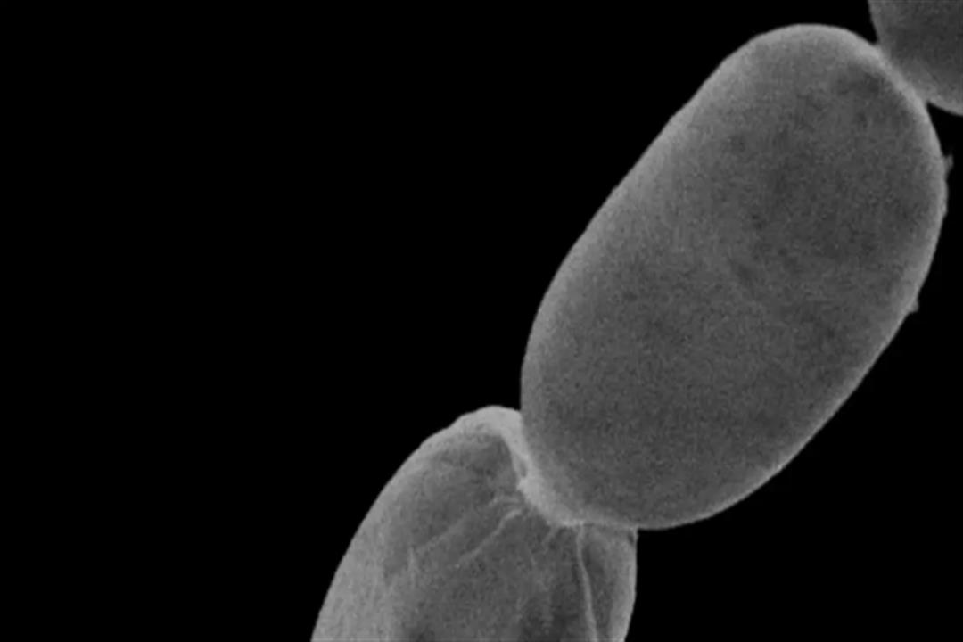 اكتشاف أكبر بكتيريا معروفة بالعالم- تُرى بالعين المجردة