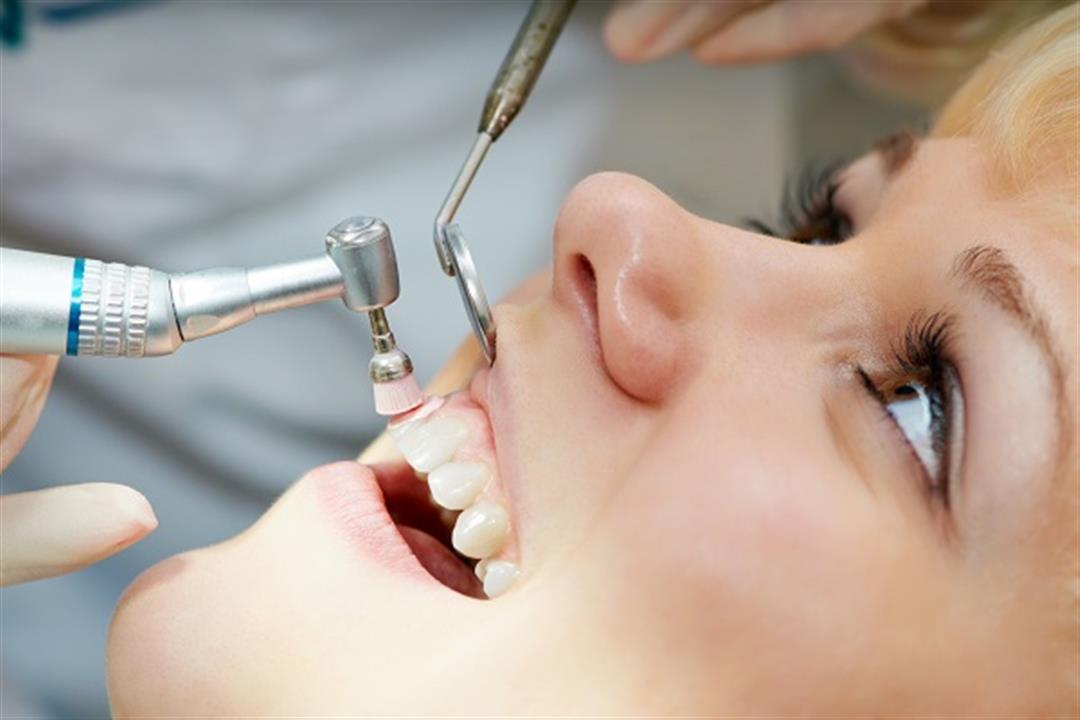 فوائد تلميع الأسنان- متى يكون ممنوعًا؟