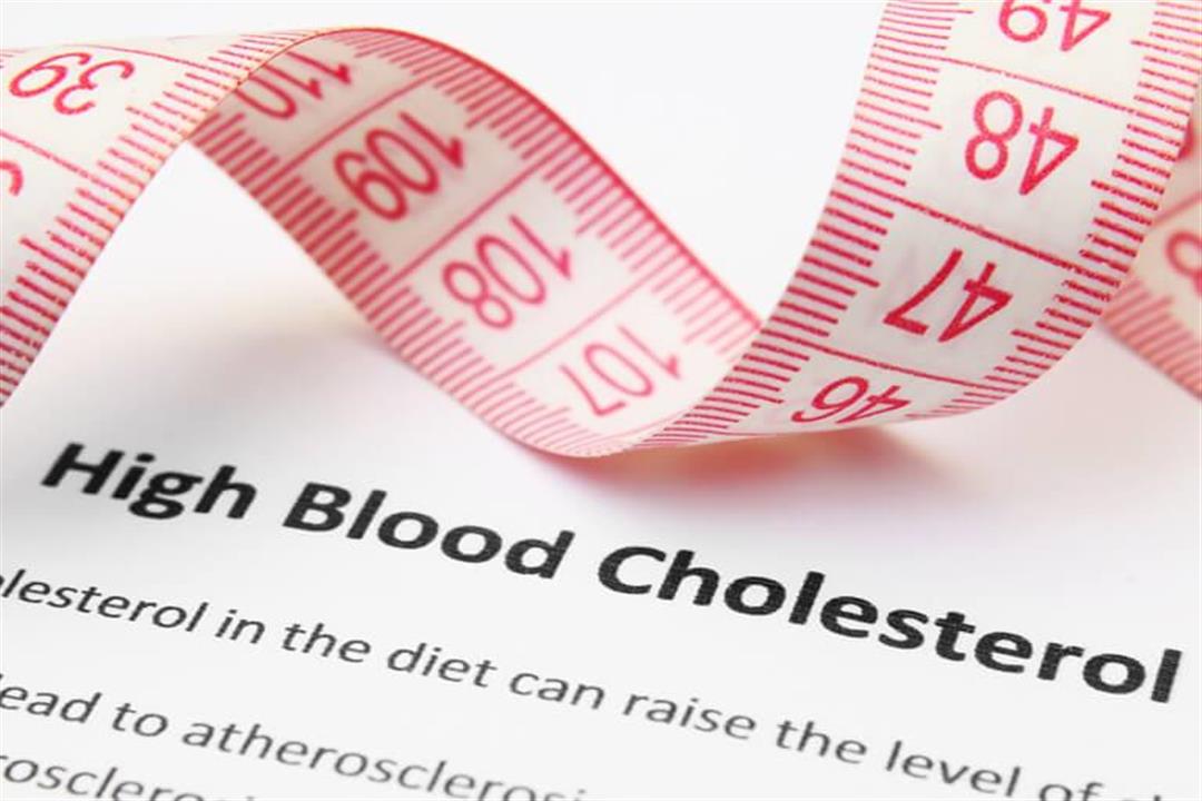 احذرها- أطعمة ترفع نسبة الكوليسترول في الدم