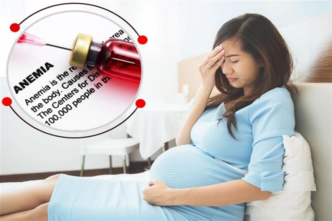 أنيميا الحمل- طبيبة تحذر: تهدد الأم والجنين بهذه المضاعفات