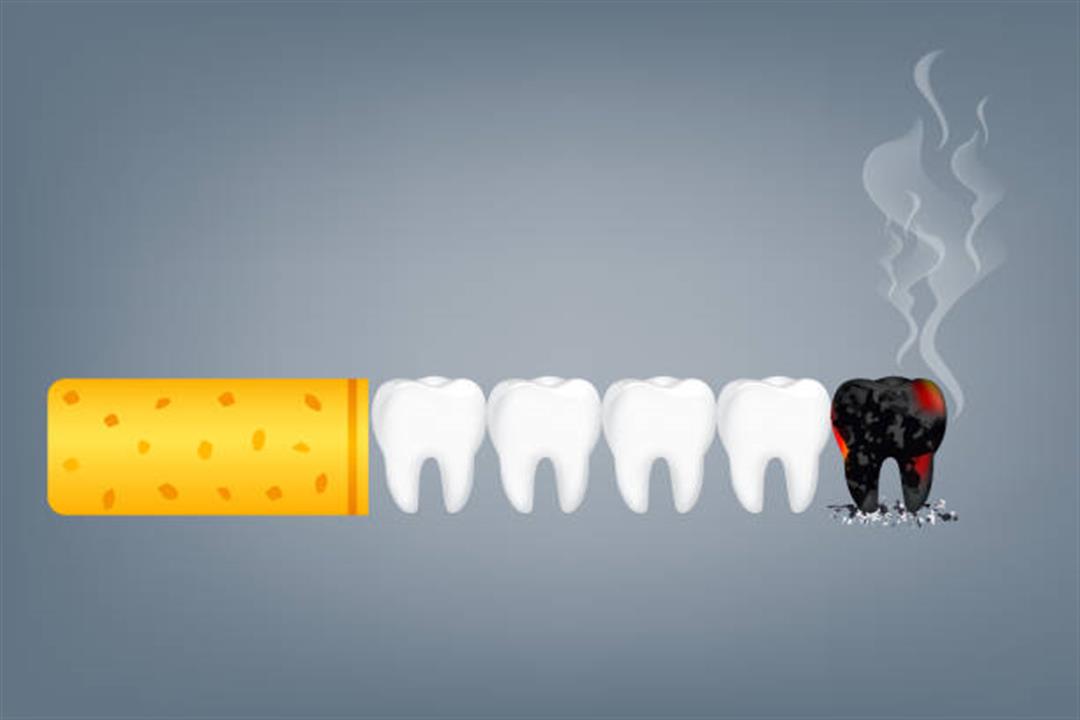 اصفرار الأسنان ليس الضرر الوحيد- كيف يؤثر التدخين على صحة الفم؟