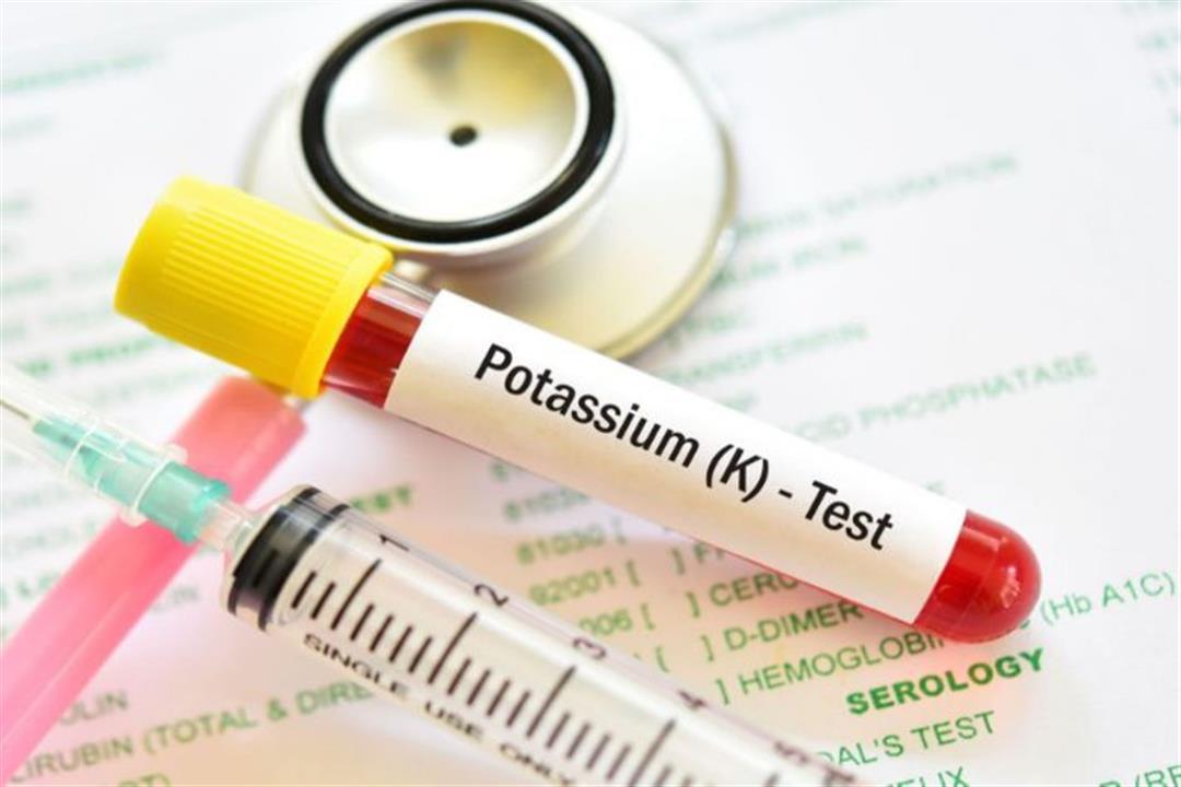 تحليل البوتاسيوم- ماذا يكشف لك؟