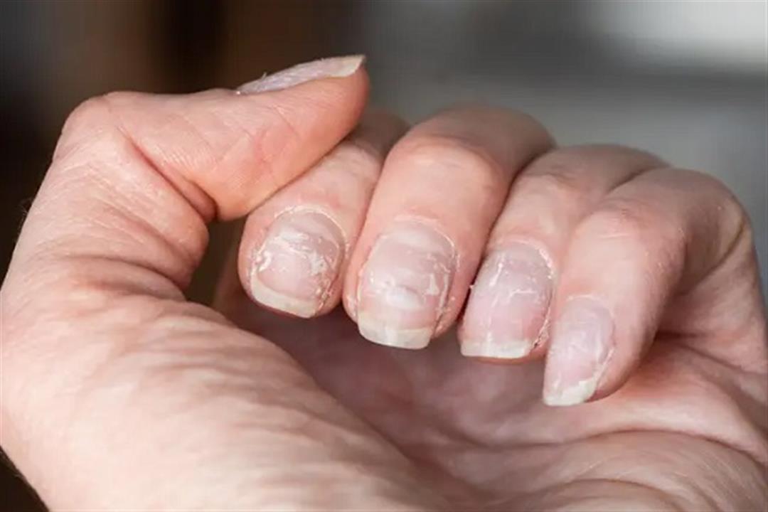 60d3ac035f52060018bbebf6