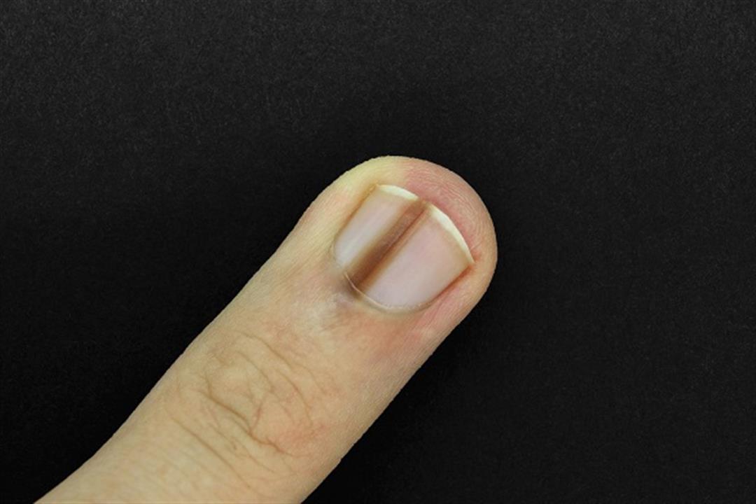 GettyImages-11659753671-67f40d2ea874415b8e35d76ad0d7967a