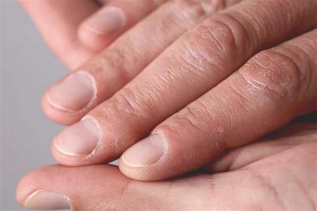 4244-hands_fingers-732x549-thumbnail-732x549