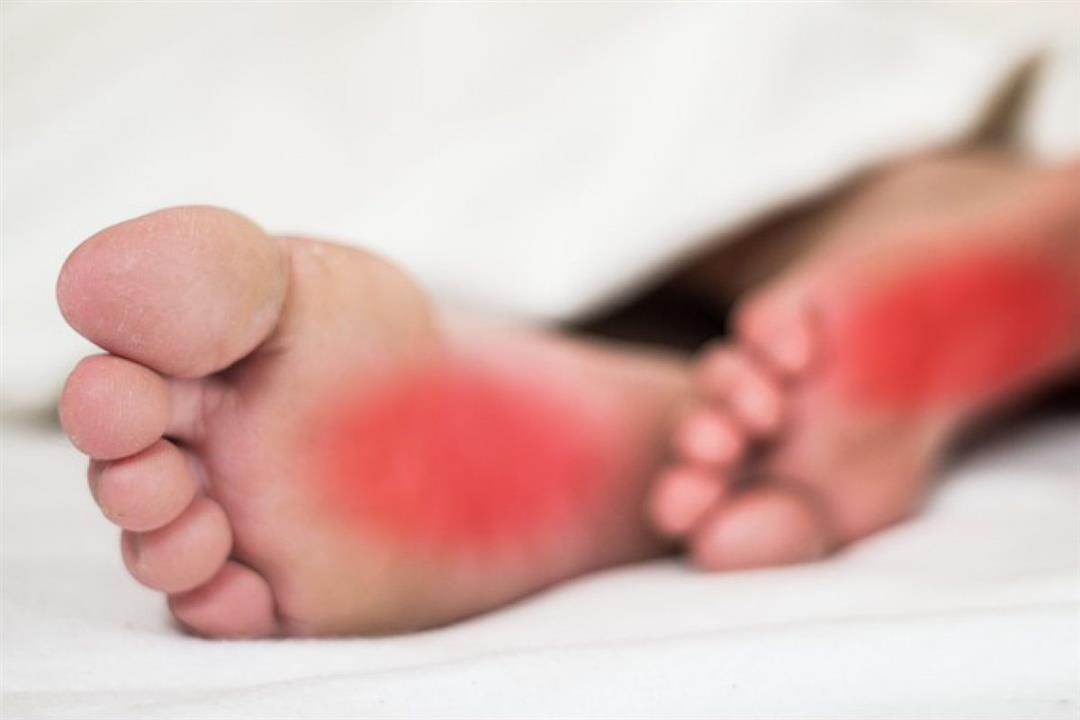 تنميل القدمين أثناء النوم- طبيب يحذر: عرض لهذه الأمراض